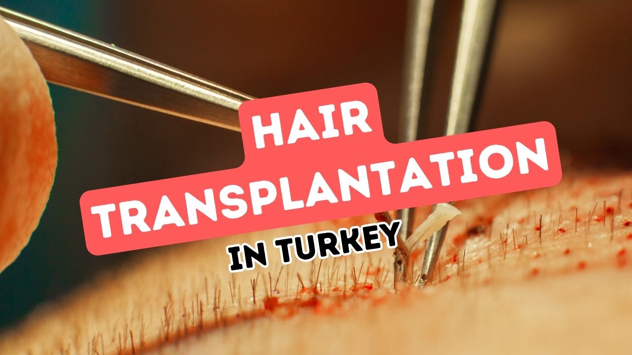 Turkey's Surge in Popularity for Hair Transplant Procedures Among International Visitors